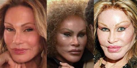 jocelyn wildenstein face before surgery.